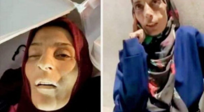 الصورة المتداولة ليست للمواطنة المجوّعة سلوى دحلان.. وإنما لشهيدة من طالبي المساعدات مجهولة الهوية