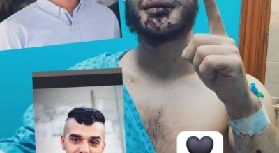 ما حقيقة خبر استشهاد المصاب عكرمة خماش؟