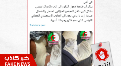 خبر كاذب.. لا وجود للتحول الجنسي في الجزائر