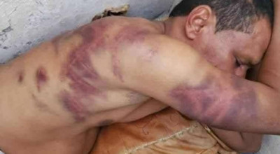 حقيقة تعذيب مواطن في مأرب الصورة المتداولة تعود لحادثة في شبوة عام 2023