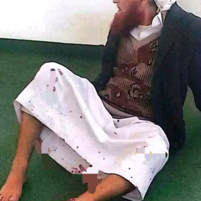 الصورة المتداولة للشيخ علي الأهنومي قديمة وتعود لحادثة 2016