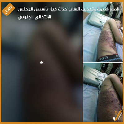الصور قديمة وتعذيب الشاب حدث قبل تأسيس المجلس الانتقالي الجنوبي