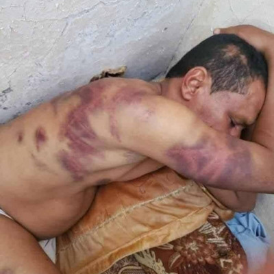 حقيقة تعذيب مواطن في مأرب الصورة المتداولة تعود لحادثة في شبوة عام 2023