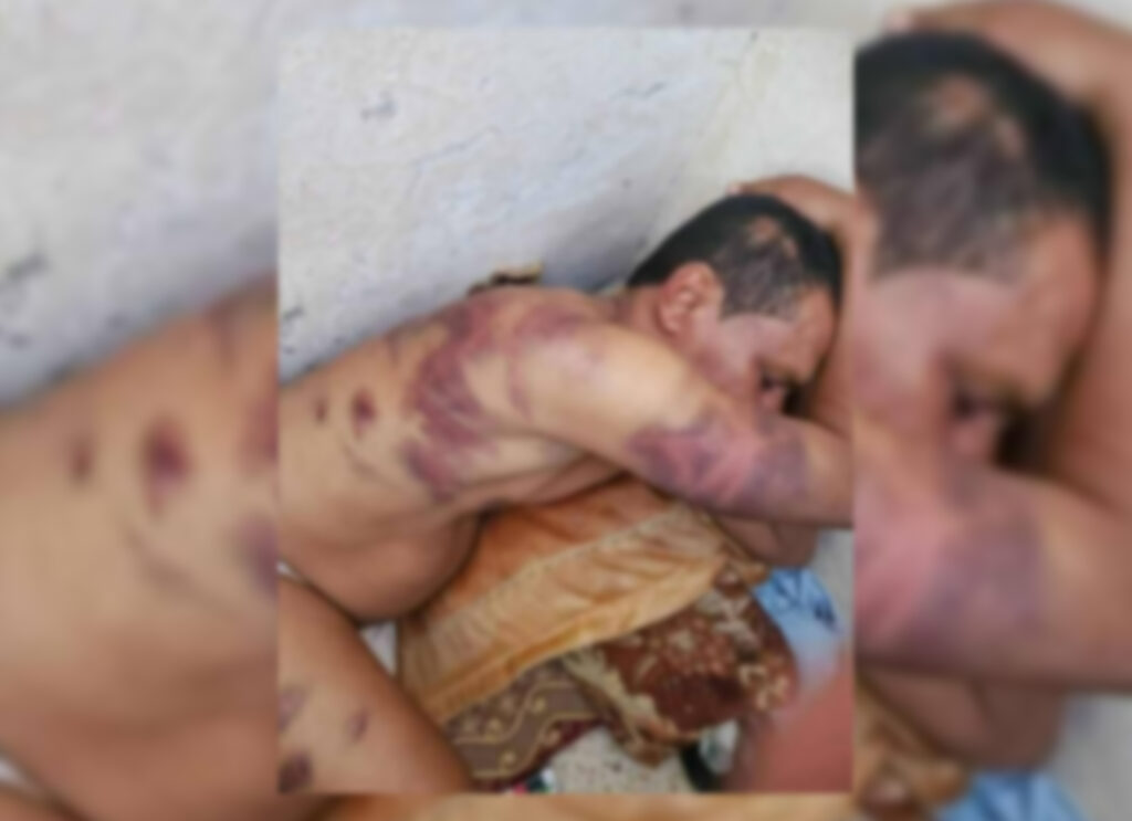 هل الصورة لمواطن تعرض للتعذيب في سجون مأرب؟