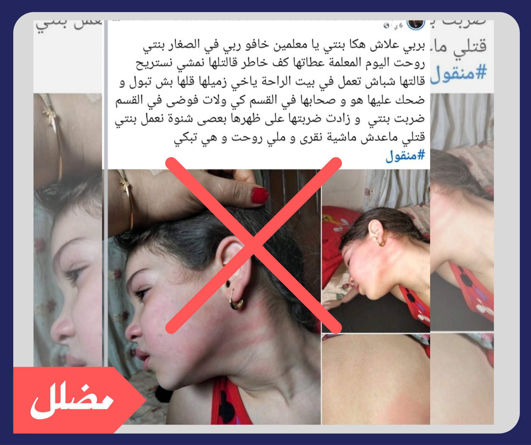 الصورة المتداولة لطفلة معنفة لا تعود لطفلة تونسية بل لطفلة مصرية