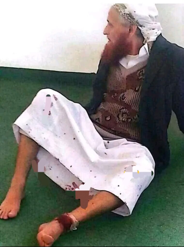 الصورة المتداولة للشيخ علي الأهنومي قديمة وتعود لحادثة 2016